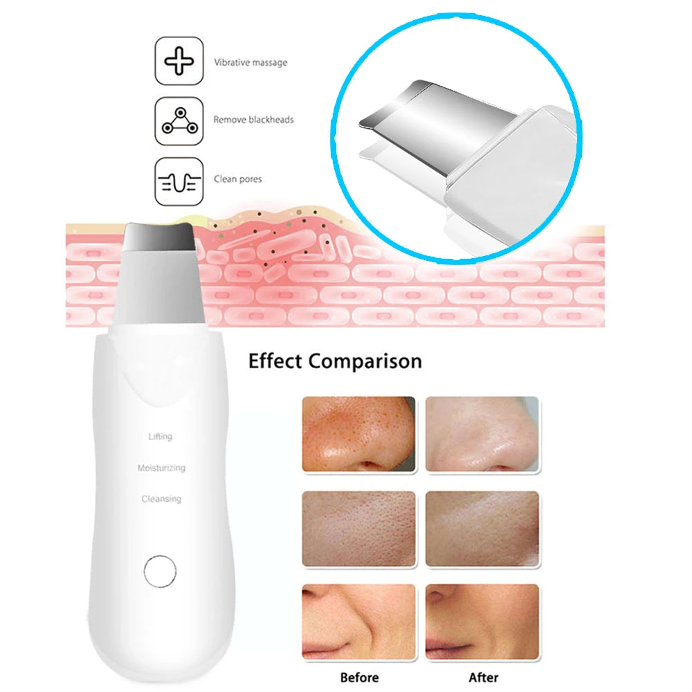 Ultrasonic skin scrubber device from Health & Beauty for deep facial cleansing and skin exfoliation.