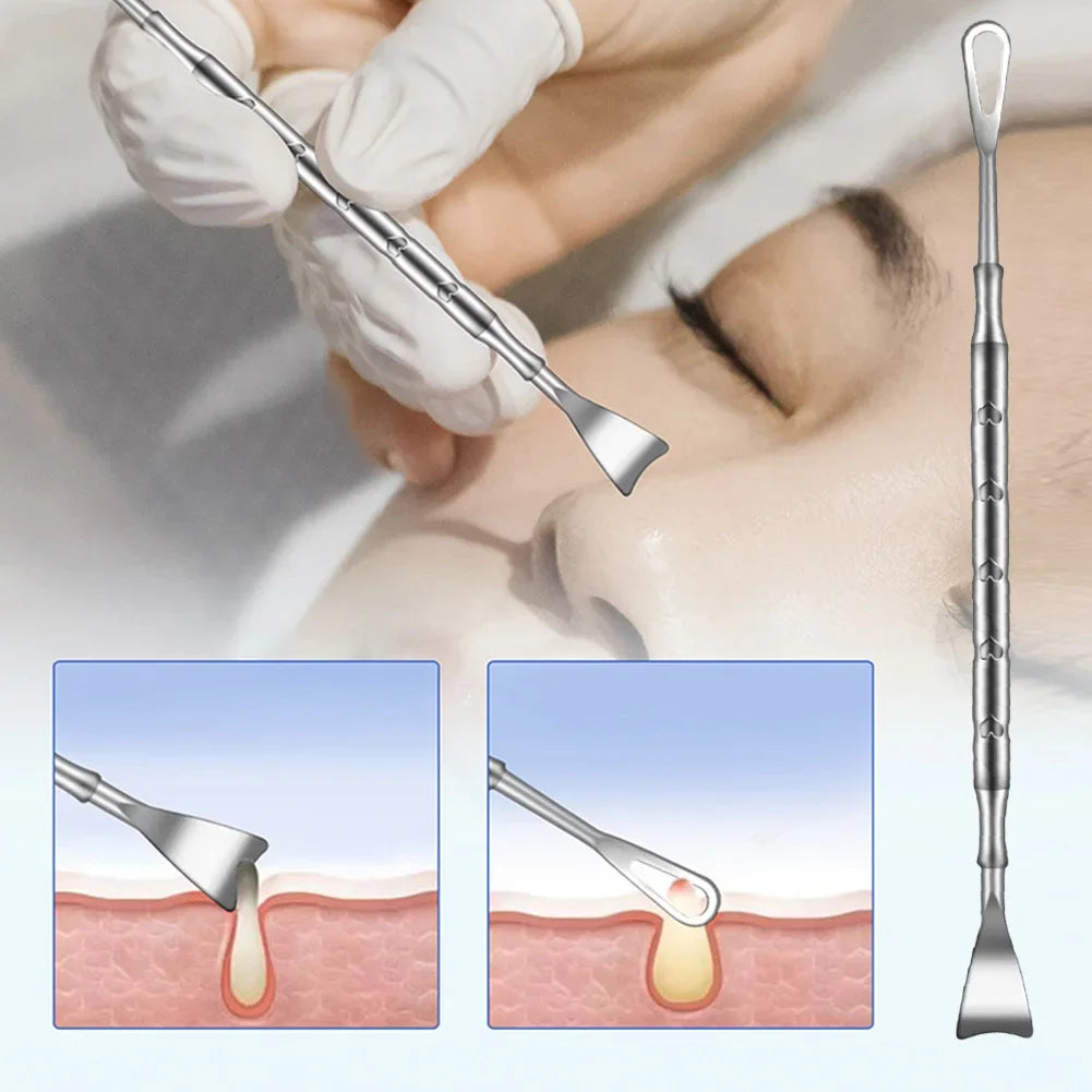Double head stainless steel blackhead remover tool with black handle, professional blemish extractor for face, pimple and comedone removal.