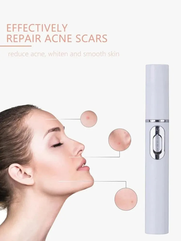 Electric eye massager wand with blue light therapy by amzzon.store for anti-aging, dark circles, and eye bag reduction.
