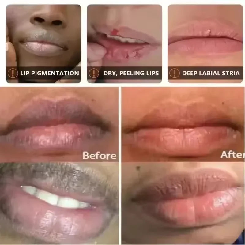 Amzzonstore melanin lip mask tube showing exfoliating and nourishing lip care serum for fading dark lips and reducing lip lines.
