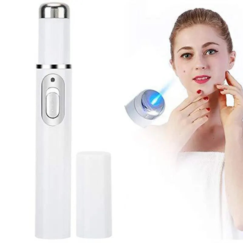 Amzzon.store electric eye massager wand with blue light therapy for anti-aging, dark circles, and eye bags in a sleek design.