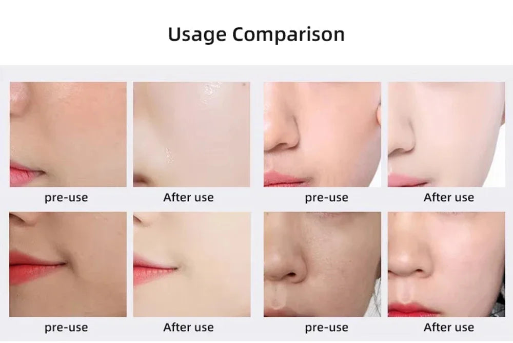 Portable CO2 oxygen bubble pen by amzzonstore, handheld facial exfoliation device with rechargeable SPA beauty capsules.