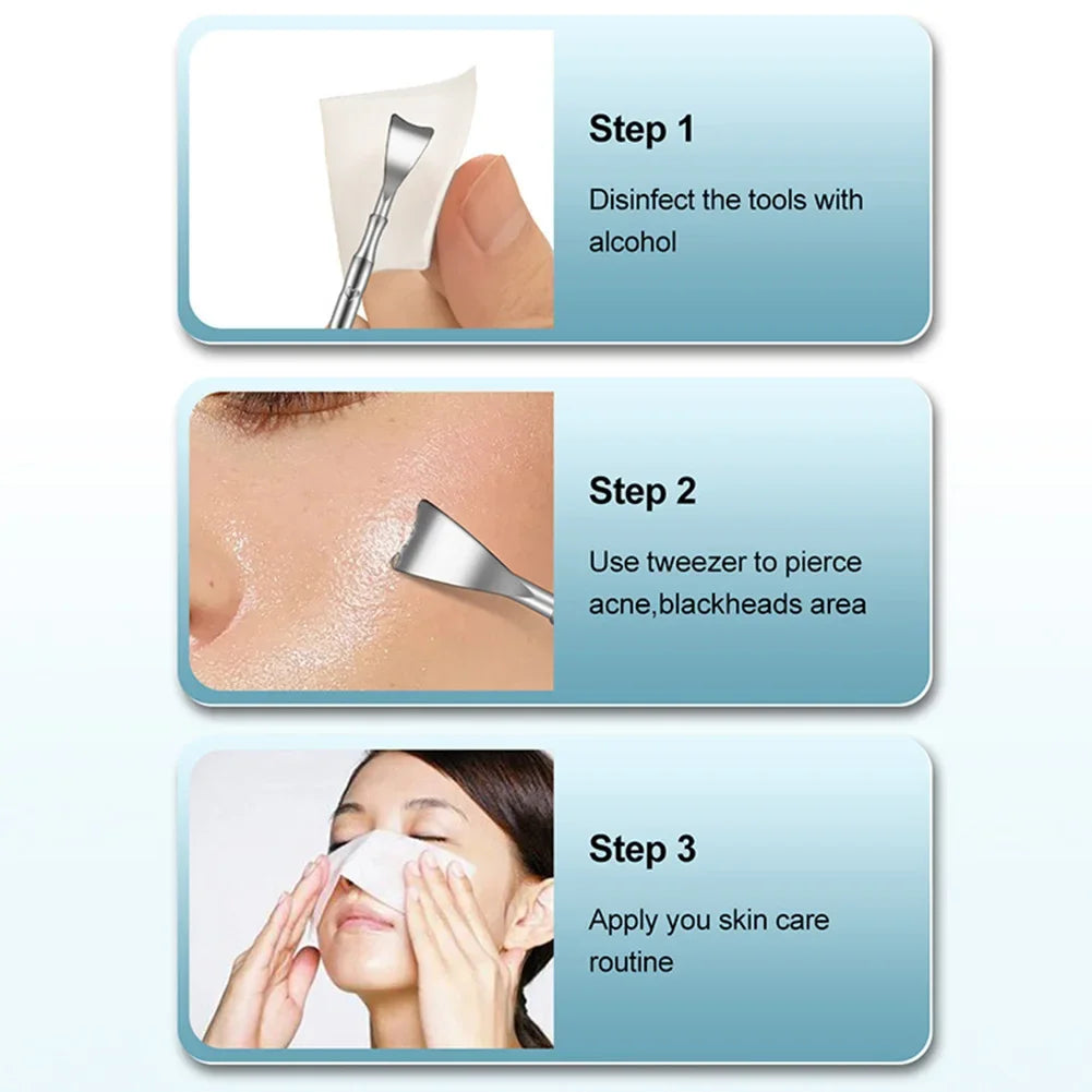 Double head stainless steel blackhead remover tool with black and silver design for face blemish and pimple extraction.