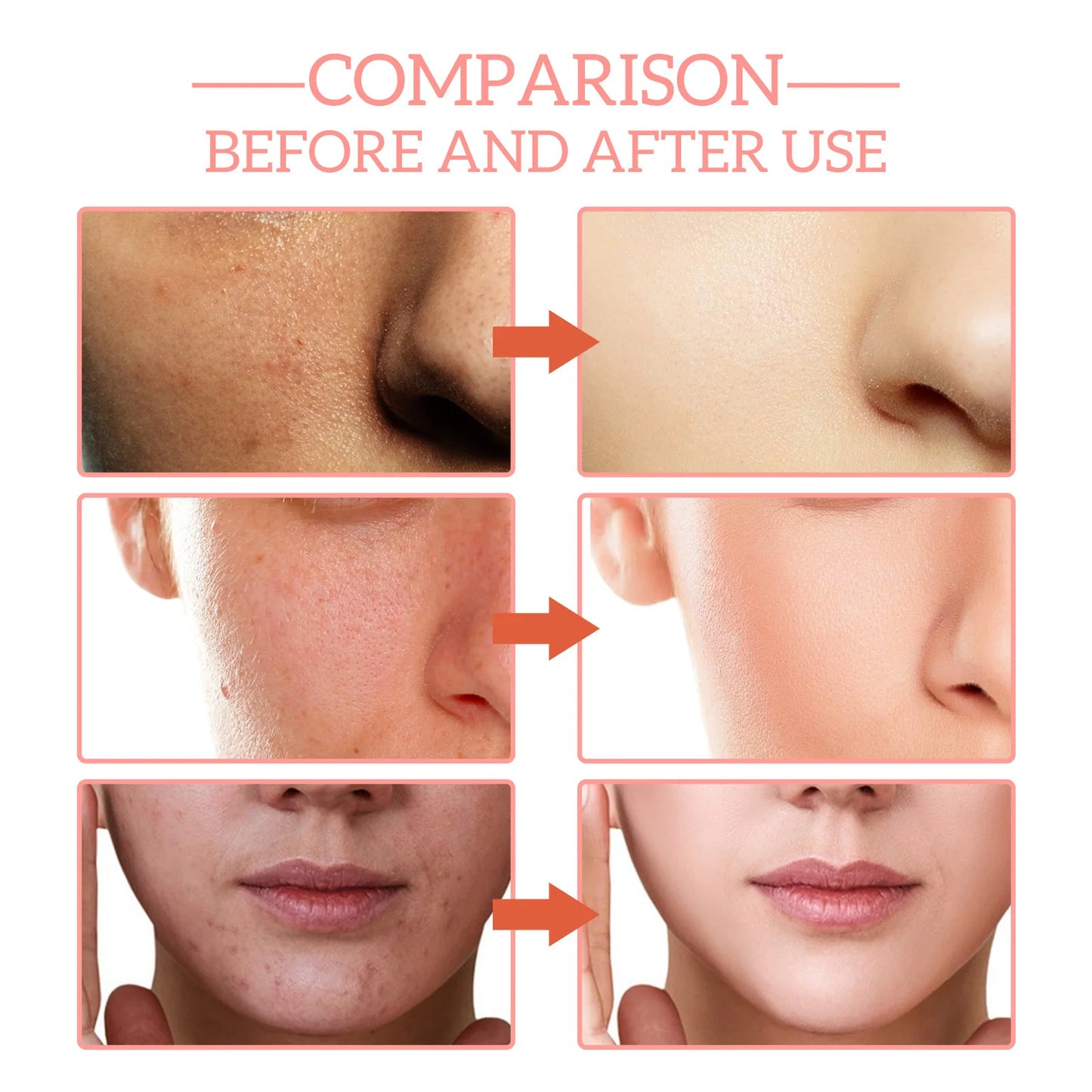 Jaysuing 5-in-1 face serum bottle, anti-aging and firming serum for wrinkles, dark spots, and deep hydration, 30ml.