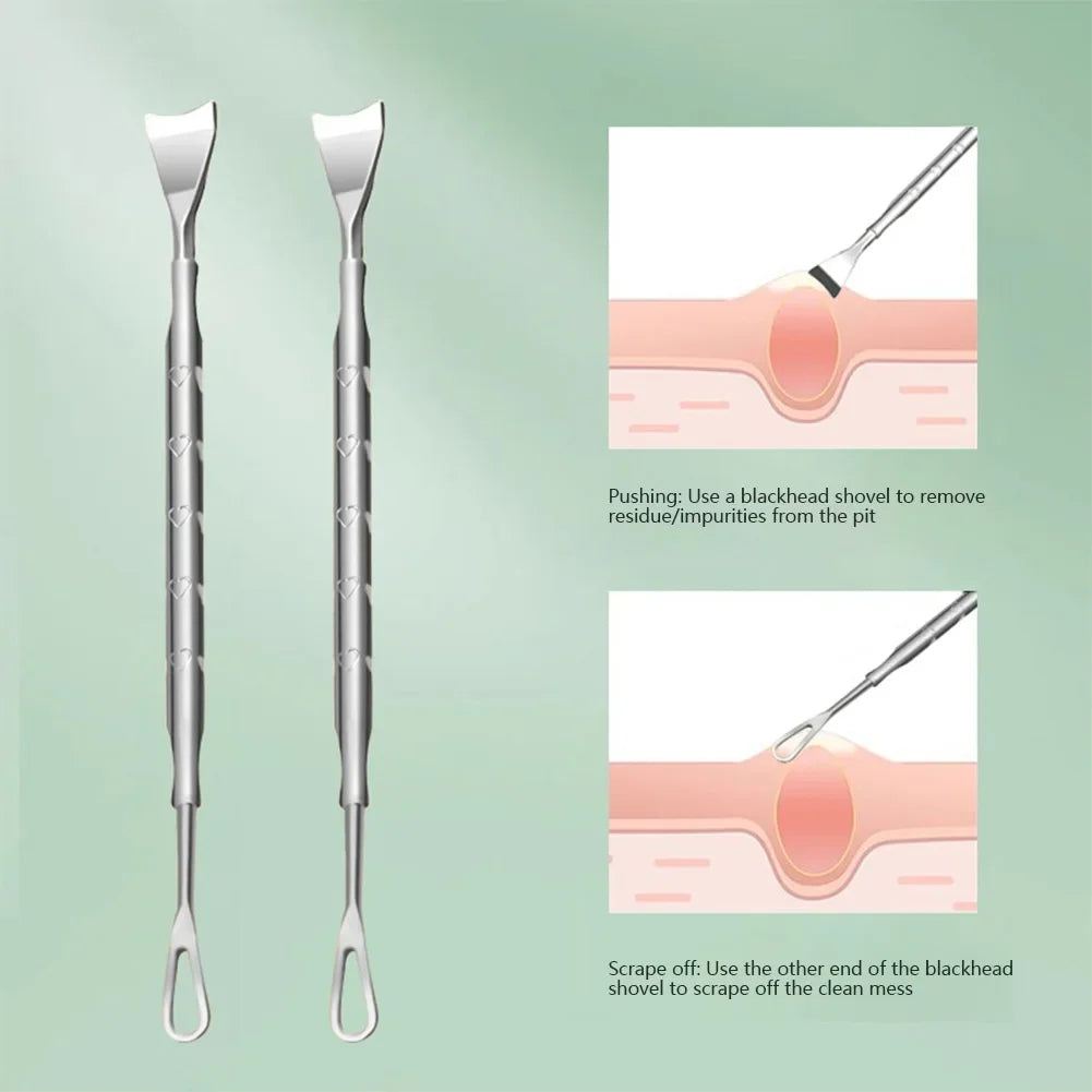 Double head stainless steel blackhead remover tool with black finish, professional blemish extractor for face acne and pimple removal.